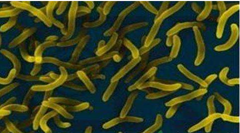 微生物菌劑好？好在哪里您知道嗎？